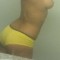 nnn
